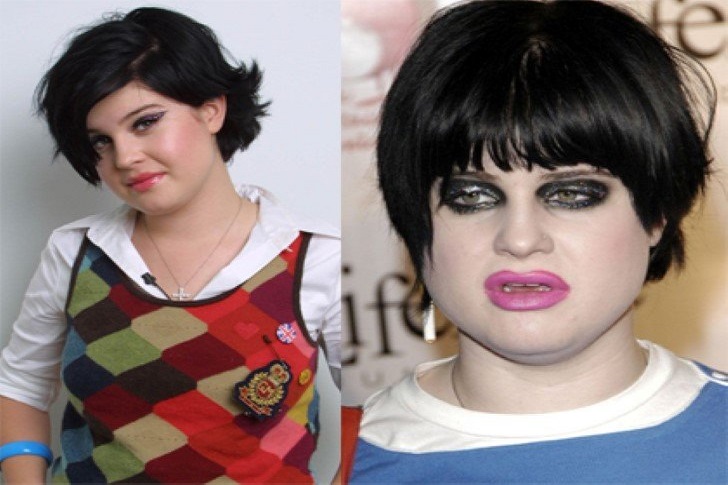 Kelly Osbourne - Dipendenza da oppiacei